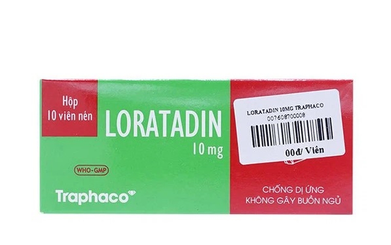 Nổi mề đay uống thuốc gì để hết bệnh? 2
