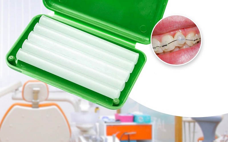Dùng sáp nha khoa để gắng nhẹ lên những mắc cài để&nbsp;hạn chế cảm giác đau