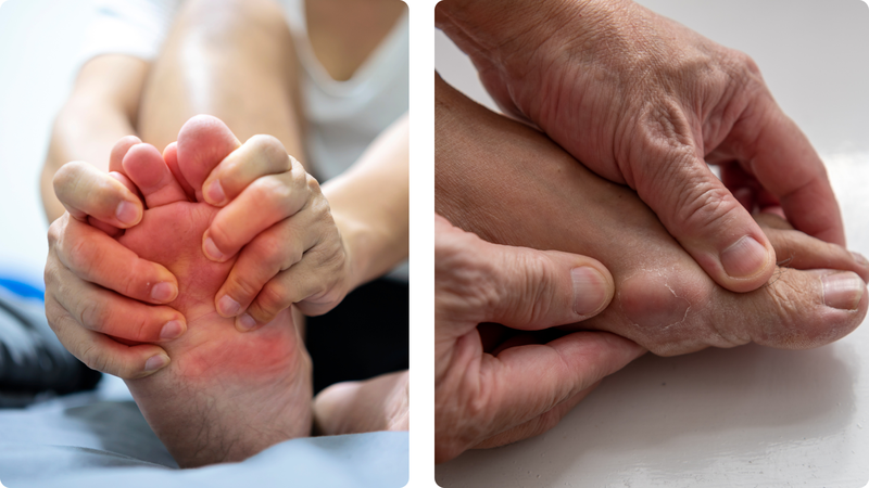 10 dấu hiệu cảnh báo axit uric trong cơ thể tăng cao mà bạn cần cảnh giác 1