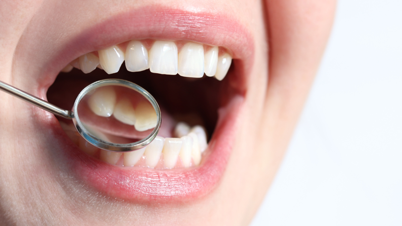 10 dấu hiệu ung thư khoang miệng thường gặp