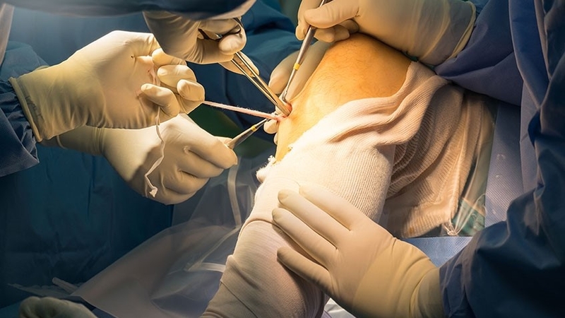 10-dieu-tranh-sau-mo-day-chang-cheo-de-nhanh-phuc-hoi 1