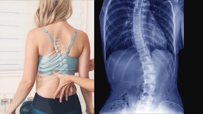 10 lợi ích khi nắn chỉnh xương khớp 3