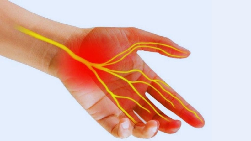 10 Triệu chứng sau khi cấy chỉ mà bạn nên biết 3