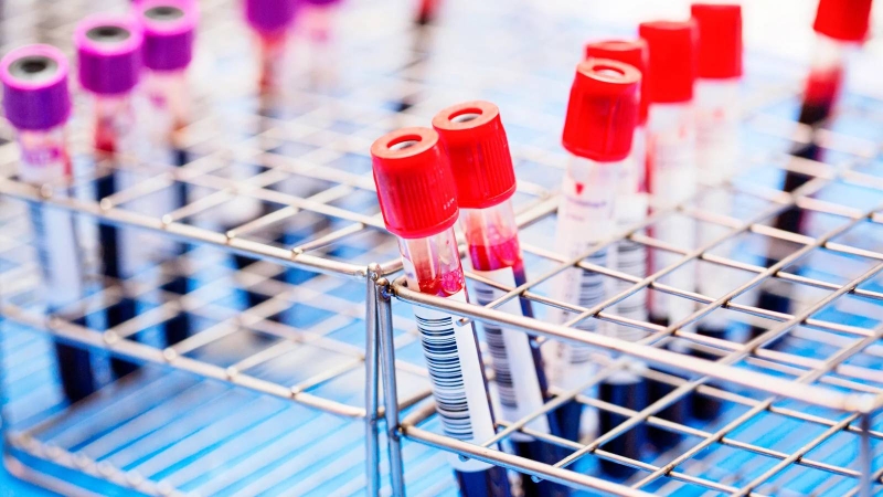 Trong máu, dấu ấn ung thư có thể tăng cao bất thường