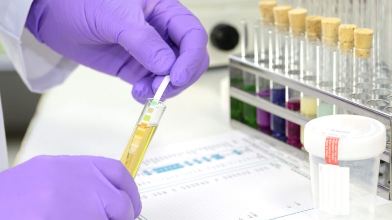 10 xét nghiệm tầm soát ung thư phổ biến hiện nay 2