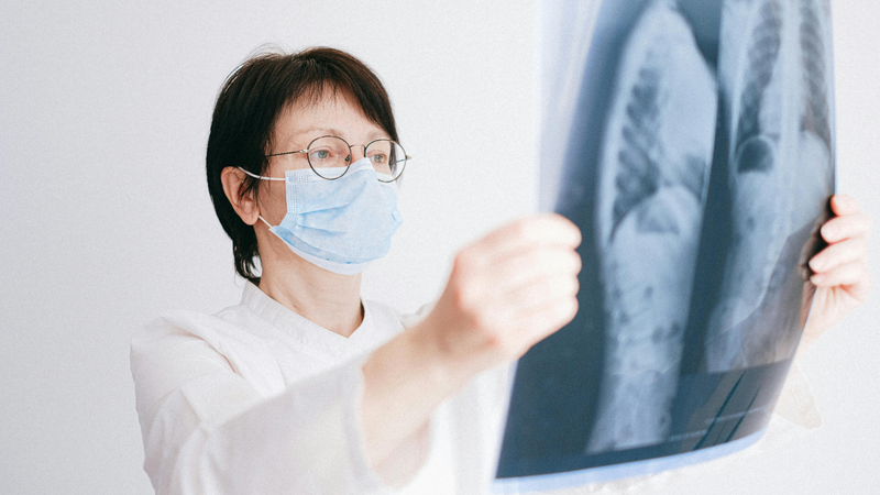 Việc phân giai đoạn ung thư phổi là bước thiết yếu để xác định mức độ lan rộng của bệnh