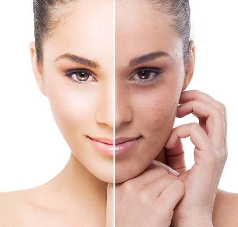 Tẩy tế bào chết cho da có quan trọng không? 2