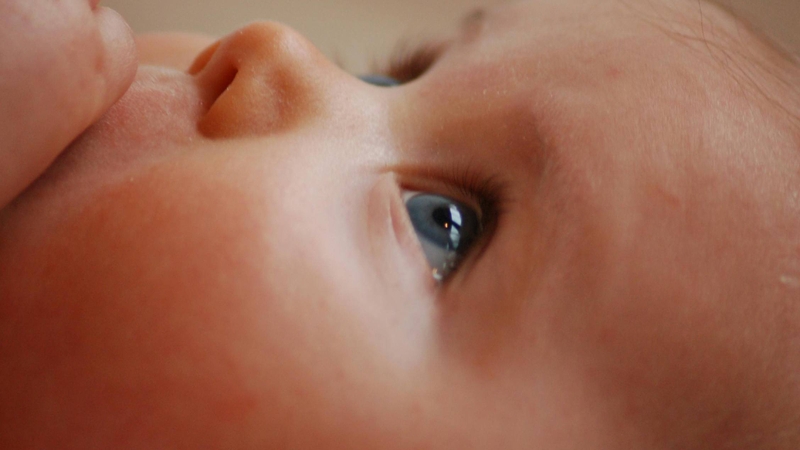 Nhiều trường hợp trẻ có hiện tượng má đỏ nhẹ, đặc biệt ở bên răng sắp nhú