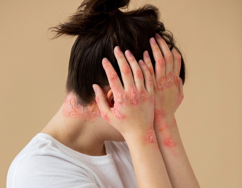 12-nguyen-nhan-bi-vay-nen-1 1.jpg