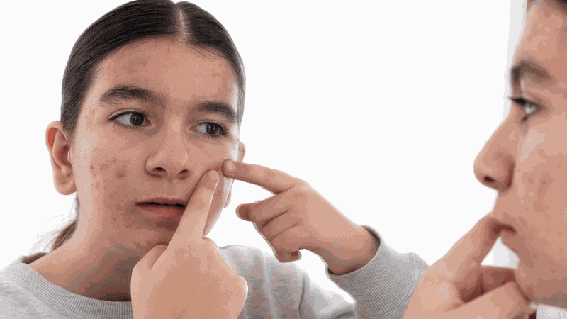 13 tuổi có nên dùng kem dưỡng da body không? 4