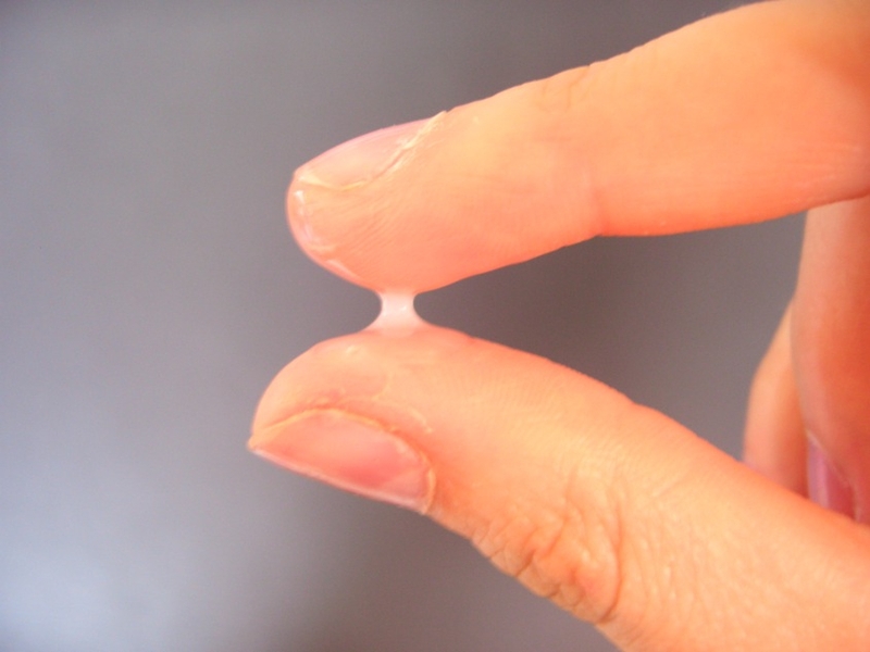 Sự thay đổi của khí hư qua các giai đoạn 2