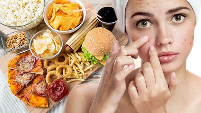 16 thói quen sinh hoạt gây mụn cần tránh 4