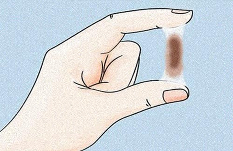 Ra khí hư màu nâu sau phá thai bằng thuốc có nguy hiểm không? 1