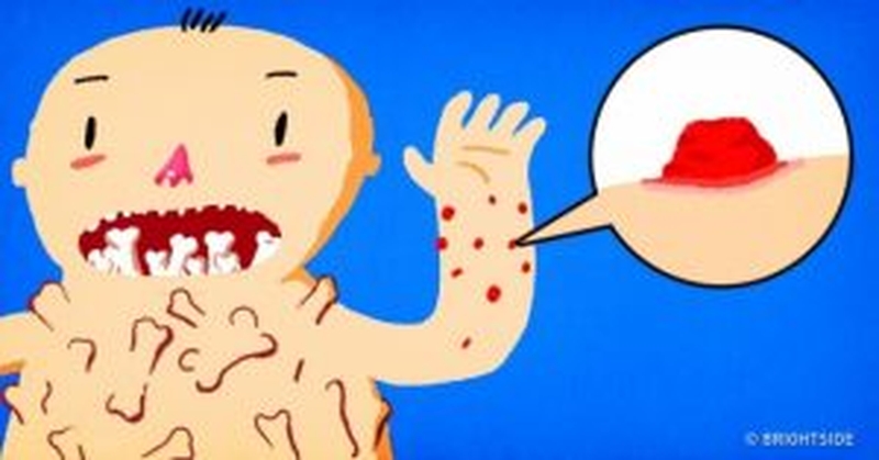 3 dau-hieu-bi-di-ung-quan-trong-thuong-gap-ma-ban-nen-biet 1