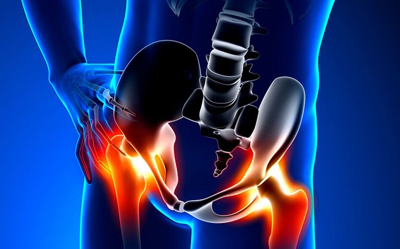 Bị giãn dây chằng háng bao lâu thì khỏi? 1