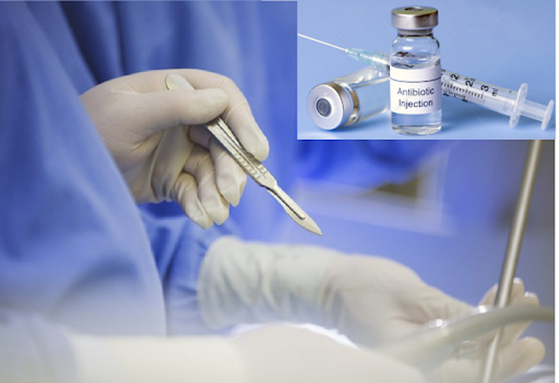 su-dung-thuoc-khang-sinh-chong-nhiem-trung-vet-thuong-2