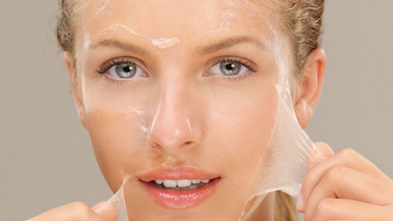 1 Lần Peel Da Bao Nhiêu Tiền? Peel Da Cần Lưu Ý Những Gì? 1