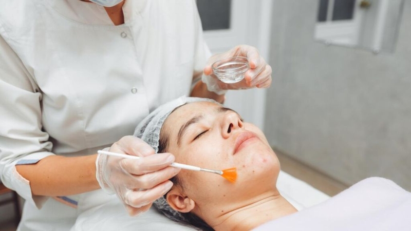 1 Lần Peel Da Bao Nhiêu Tiền? Peel Da Cần Lưu Ý Những Gì? 2