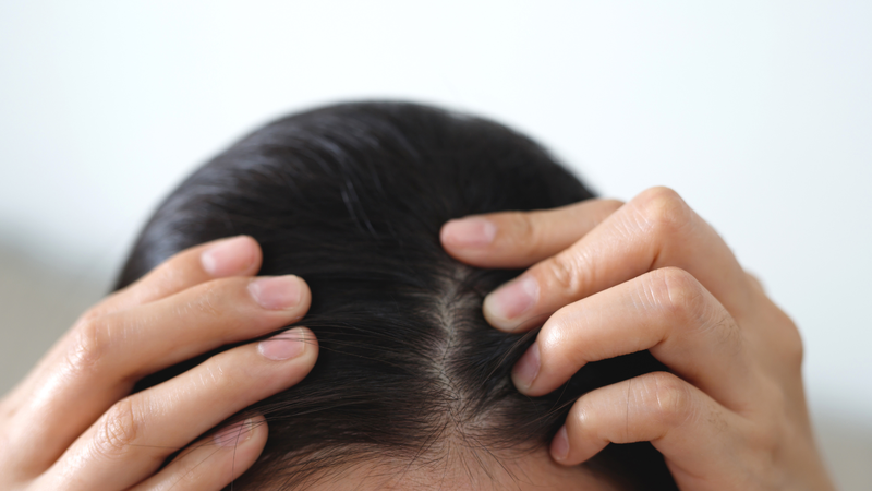 1-ngay-toc-moc-bao-nhieu-soi-nguyen-nhan-gay-rung-toc-va-mot-so-meo-giup-toc-moc-nhanh-hon 2.png