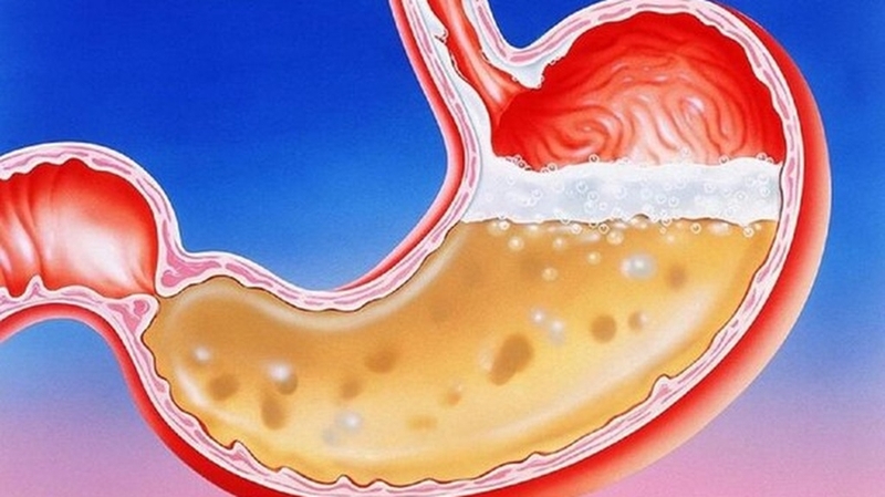 phan-xa-ruot-da-day-va-nhung-dieu-ban-nen-biet 1