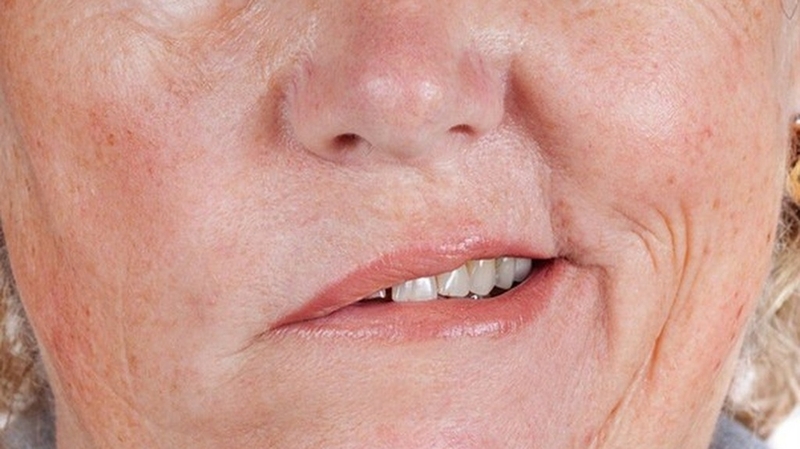 tai-sao-bi-liet-mat-cac-phuong-phap-phuc-hoi-chuc-nang-sau-khi-bi-liet-mat-la-gi 1