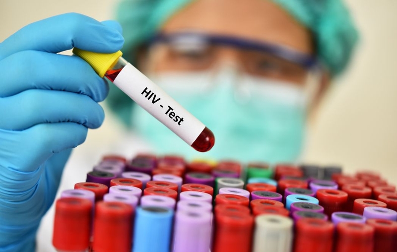 Giải đáp thắc mắc: 1 tháng xét nghiệm HIV có chính xác không 1
