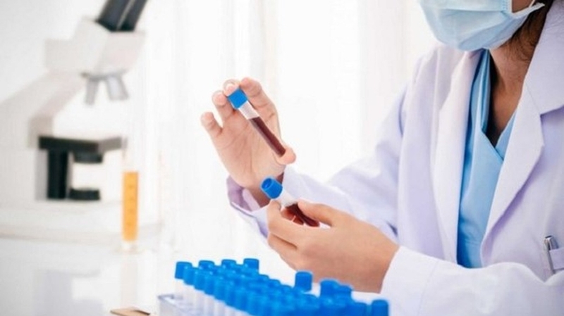 Xét nghiệm CK - MB là gì? Tại sao cần làm xét nghiệm CK - MB?+1