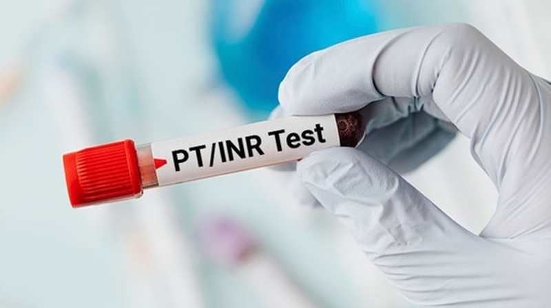 Xét nghiệm INR - Phương pháp đánh giá tình trạng đông máu+1