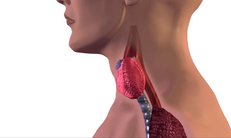 bướu cổ lành tính có nên mổ không 3