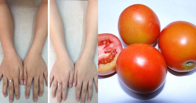 Phương pháp làm trắng da tay bị cháy nắng nhanh chóng 2