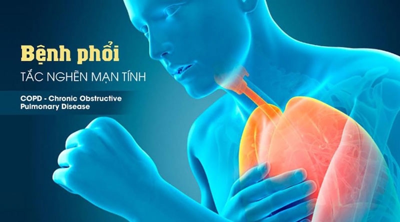 Bệnh phổi tắc nghẽn mãn tính có chữa được không? 1