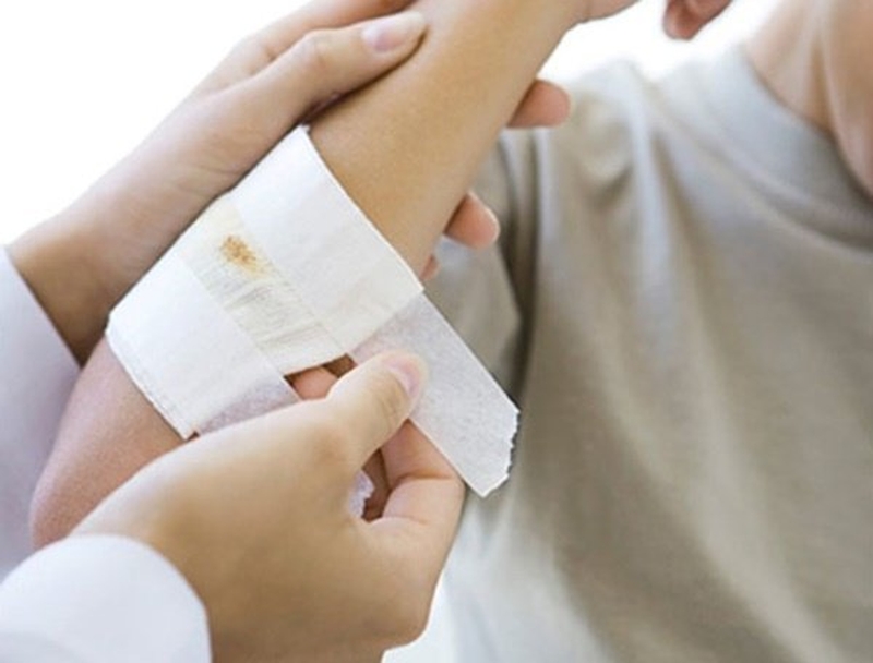 Review Nacurgo màng sinh học băng vết thương dạng xịt 3