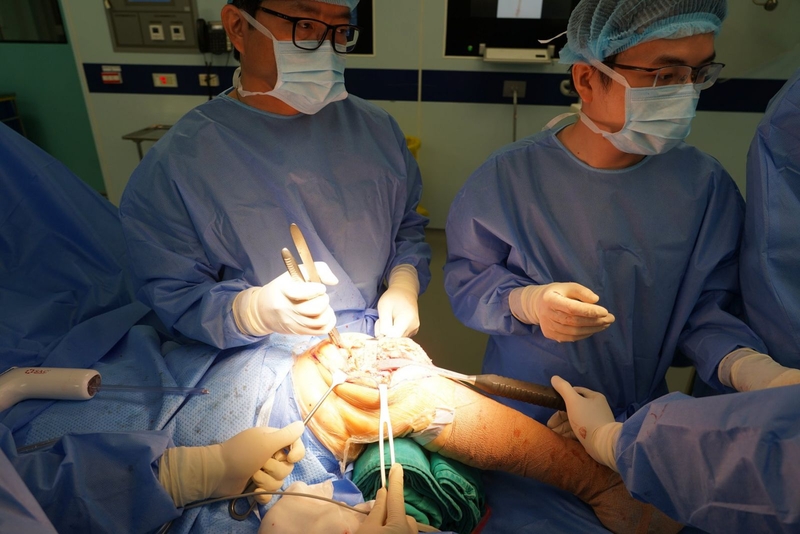 Phẫu thuật chấn thương chỉnh hình là gì? 1