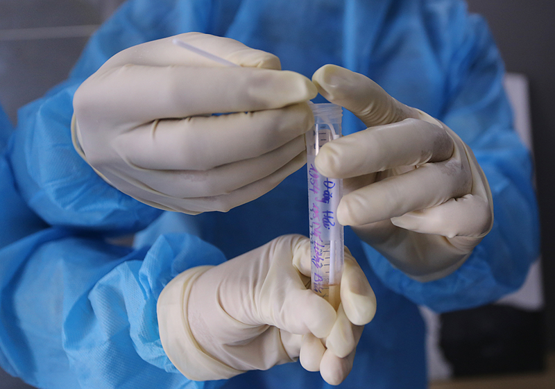 Chi phí xét nghiệm COVID-19 là bao nhiêu sẽ tuỳ thuộc vào từng phương pháp xét nghiệm