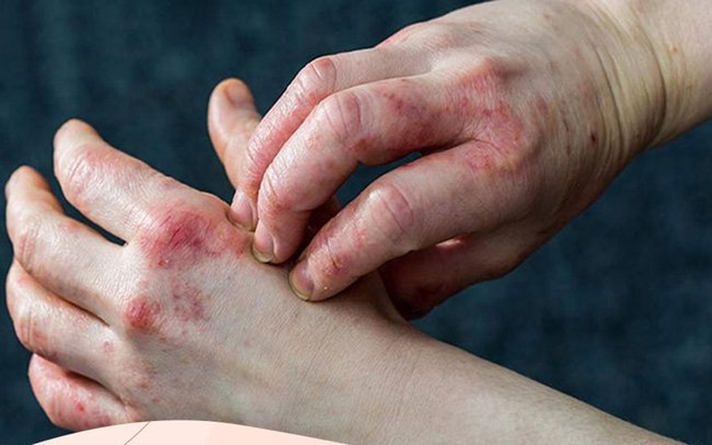 dua-muoi-voi-nguoi-tieu-duong-co-loi-hay-co-hai 2