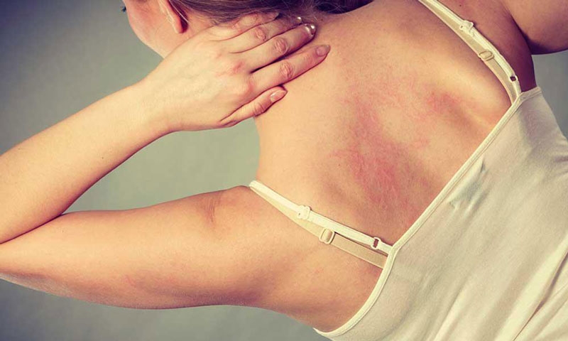 Xét nghiệm lupus ban đỏ ở đâu chính xác và an toàn? 1