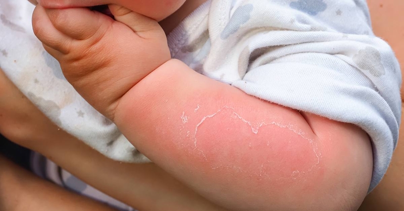 Hướng dẫn cách sơ cứu 5 loại chấn thương hay xảy ra ở trẻ nhỏ 2