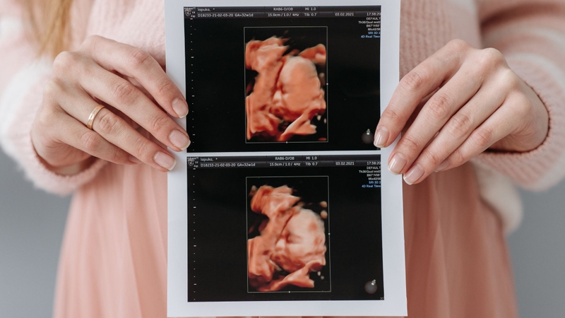 25 tuần là mấy tháng? Thai 25 tuần phát triển như thế nào? 1