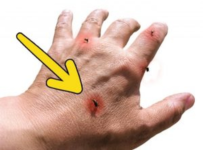 3 dau-hieu-bi-di-ung-quan-trong-thuong-gap-ma-ban-nen-biet 2