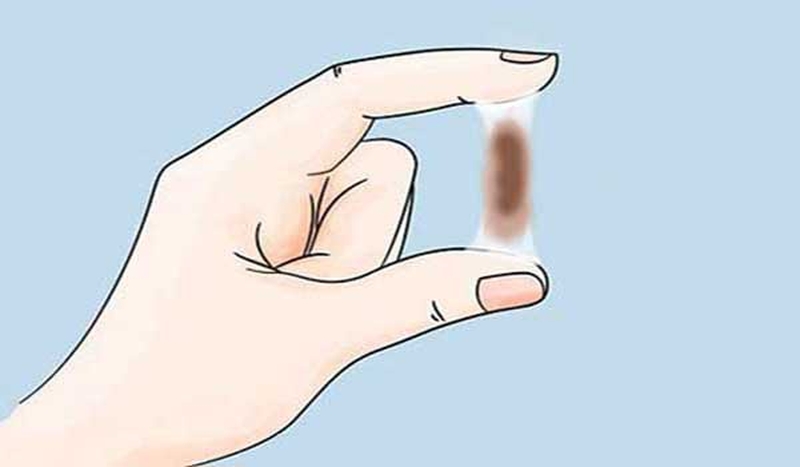 Đặt vòng tránh thai bị ra huyết nâu có nguy hiểm không? 2