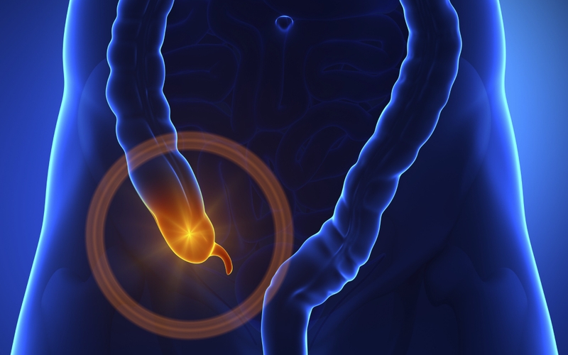 Một số mẹo xì hơi sau mổ ruột thừa giúp hiệu quả 1