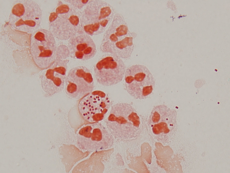 moraxella-catarrhalis-la-gi-vi-khuan-gay-benh-gi 2.jpeg