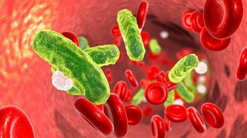 Hội chứng Ure máu cao là gì? Nguyên nhân và cách phòng tránh + 2