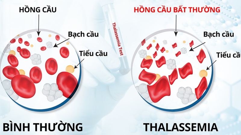 2-nhom-mau-nao-khong-nen-lay-nhau-dieu-can-biet-de-tranh-rui-ro-cho-con-cai2.jpg