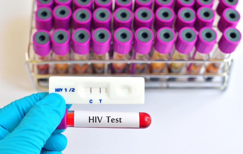 Sau khi tiếp xúc với HIV 2 tháng xét nghiệm HIV có chính xác không 1