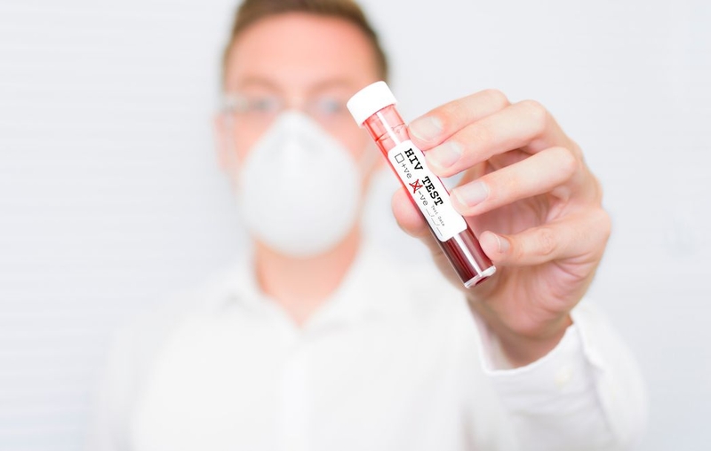 Sau khi tiếp xúc với HIV 2 tháng xét nghiệm HIV có chính xác không 4
