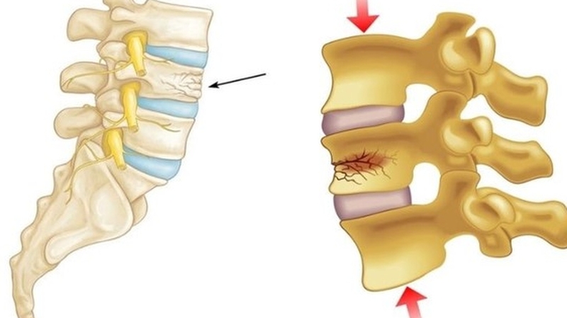 Xét nghiệm HLA B27 là gì? Tại sao cần làm xét nghiệm HLA B27?+2