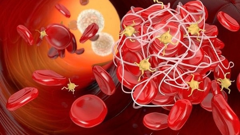 Xét nghiệm Prothrombin (PT) là gì? Tại sao cần làm xét nghiệm PT?+2