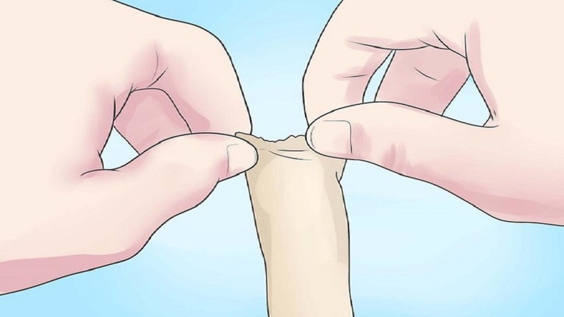 Giải thích chi tiết: 30 tuổi có nên cắt bao quy đầu không? 1