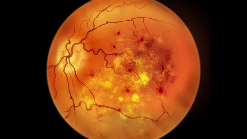 30 tuổi có bị tiểu đường không? Kiểm soát bằng cách nào? 3